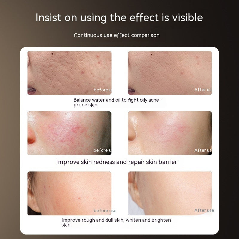 Photon IPL LED Beauty Mask – Home Phototherapy Device for Skin Rejuvenation & Acne Treatment