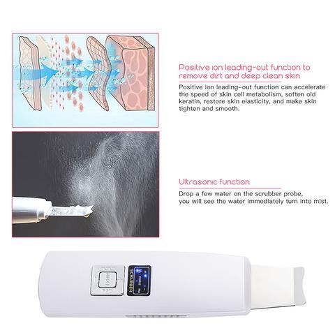 Ultrasonic Skin Scrubber 394 | Face Cleanser, Blackhead & Acne Removal, Peeling & Facial Spa Vibration Massager