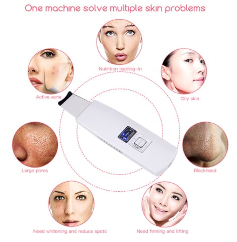 Ultrasonic Skin Scrubber 394 | Face Cleanser, Blackhead & Acne Removal, Peeling & Facial Spa Vibration Massager