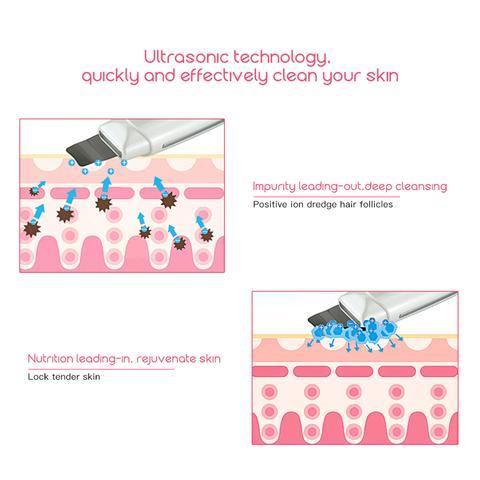 Ultrasonic Skin Scrubber 394 | Face Cleanser, Blackhead & Acne Removal, Peeling & Facial Spa Vibration Massager