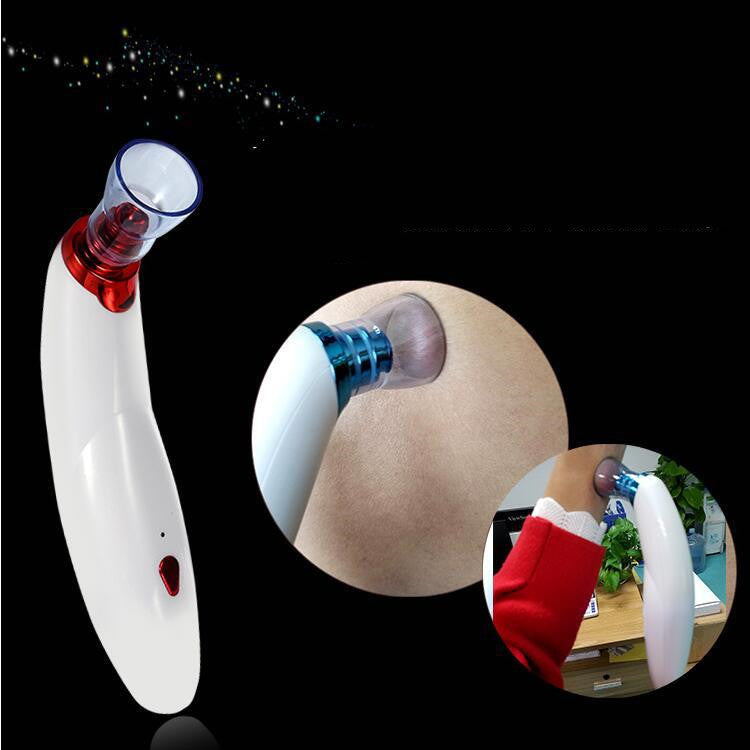 Electric Blackhead Remover Vacuum – Acne Pore Cleaner & Multifunctional Suction Device