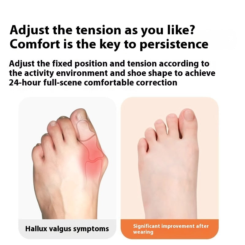 Hallux Valgus Bunion Corrector Brace – Pre-Slitting Elastic Muscle Patch (Wearable in Shoes)